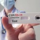 test-sierologico-coronavirus